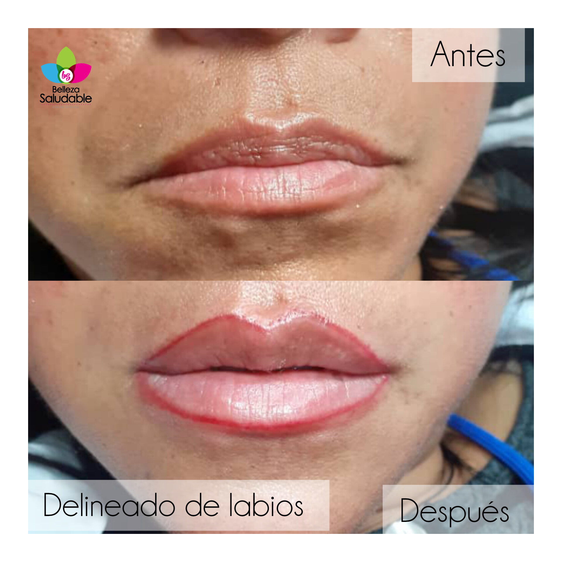 Resultado